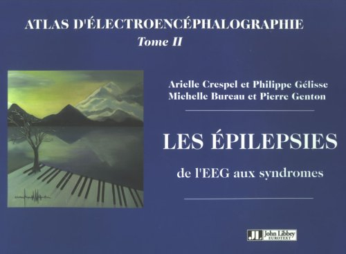 Atlas d'électroencéphalographie. Vol. 2. Les épilepsies, de l'EEG aux syndromes