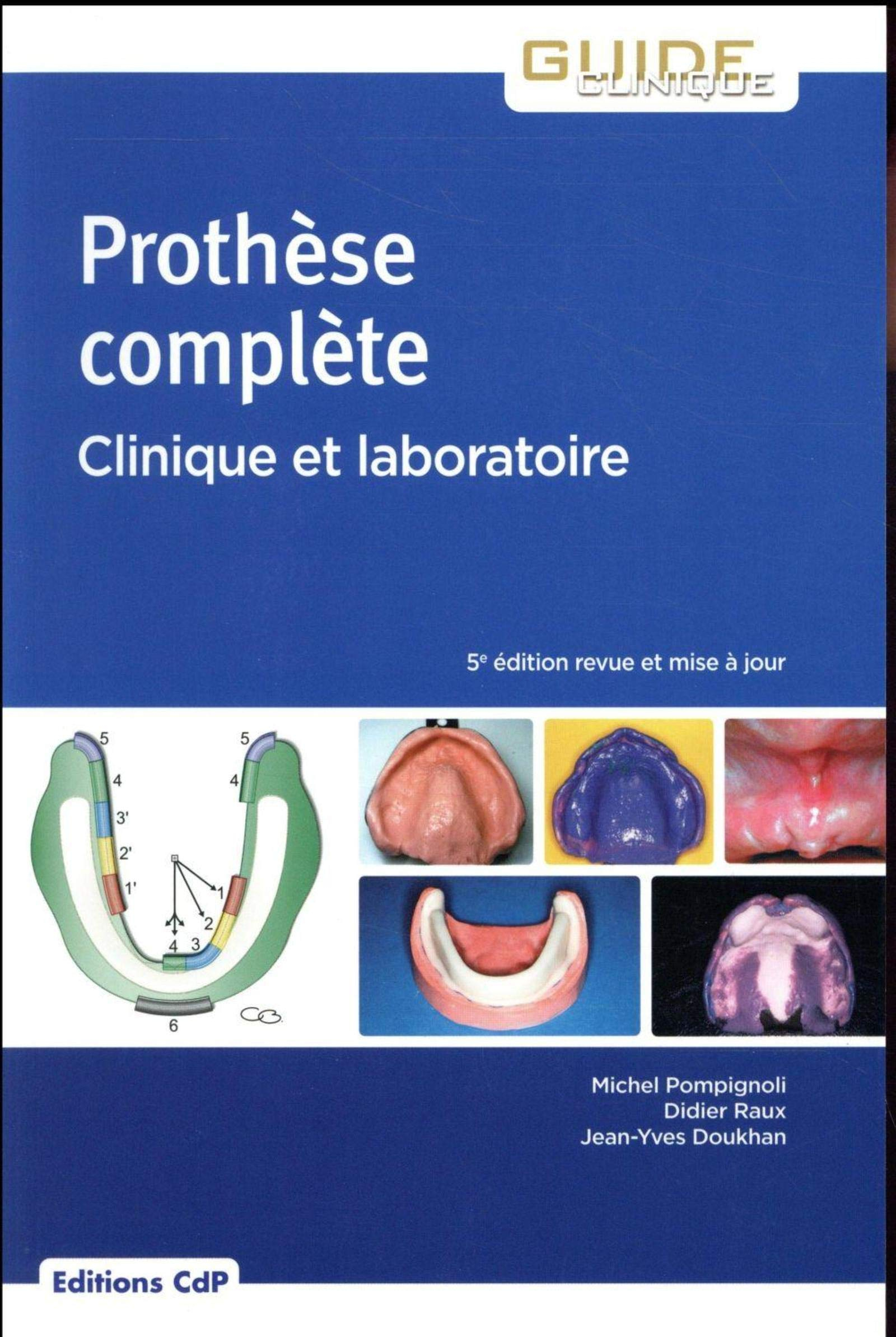 Prothèse complète : clinique et laboratoire