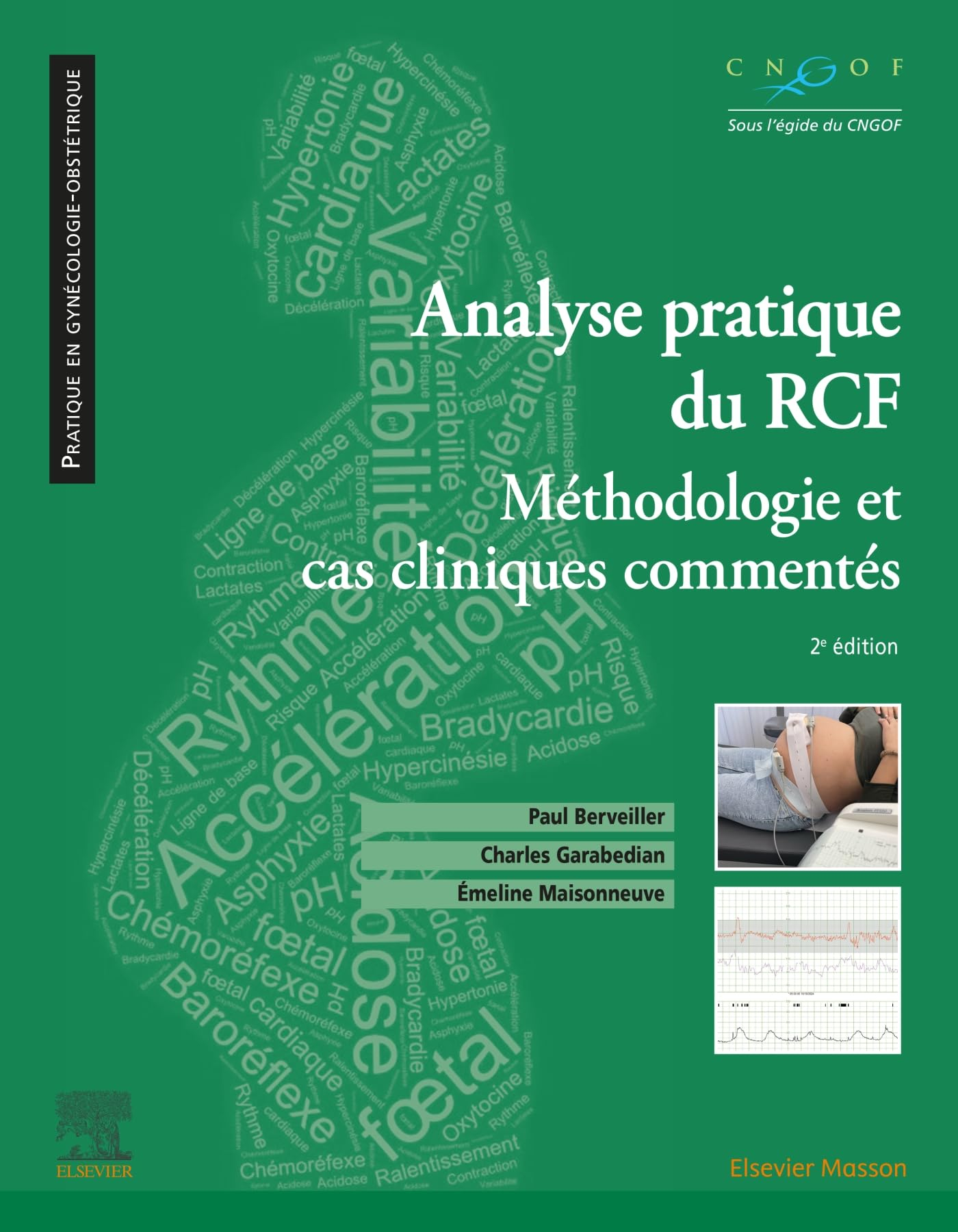 Analyse pratique du RCF : rythme cardiaque foetal: Méthodologie et cas cliniques commentés