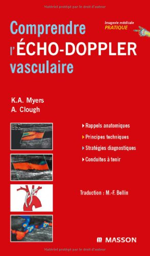 Comprendre l'écho-Doppler vasculaire