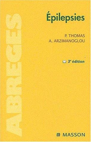 Epilepsies