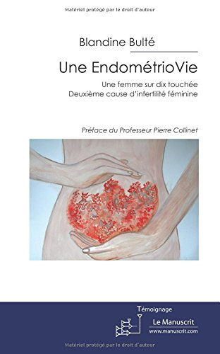 une endométriovie: une femme sur dix touchée. deuxième cause d'infertilité féminine