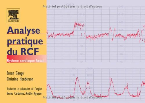 Analyse pratique du RCF, rythme cardiaque foetal