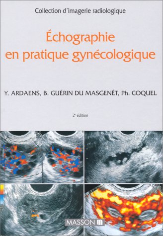 ECHOGRAPHIE EN PRATIQUE GYNECOLOGIQUE 2EME ED