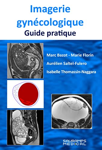 Imagerie gynécologique : guide pratique