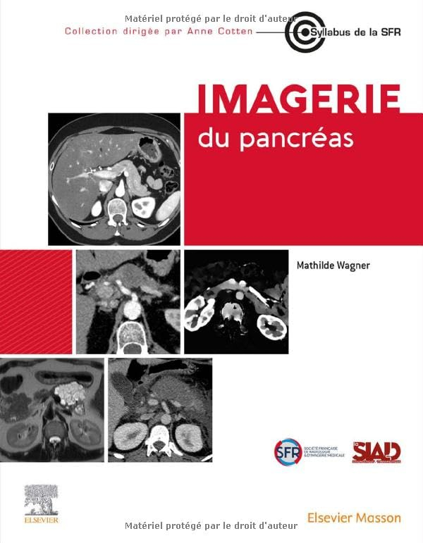 Imagerie du pancréas