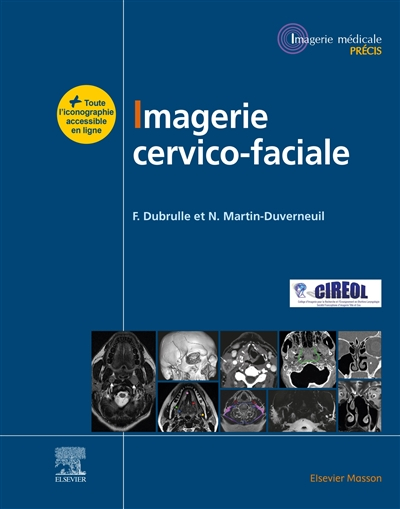Imagerie cervico-faciale