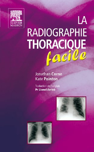 La radiographie thoracique facile