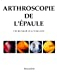Arthroscopie de l'épaule