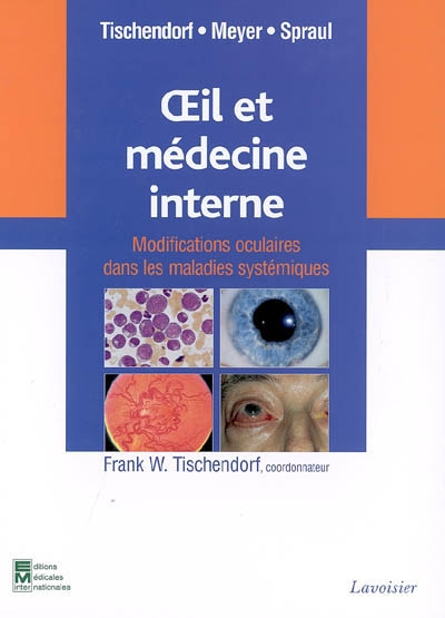 Oeil et médecine interne : modifications oculaires dans les maladies systémiques
