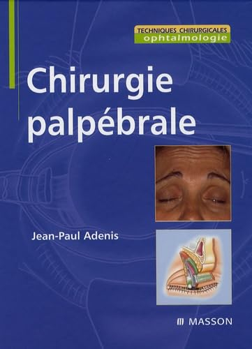 Chirurgie palpébrale