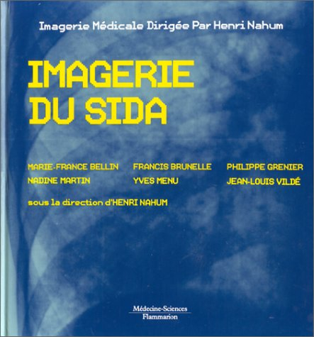 Imagerie du sida