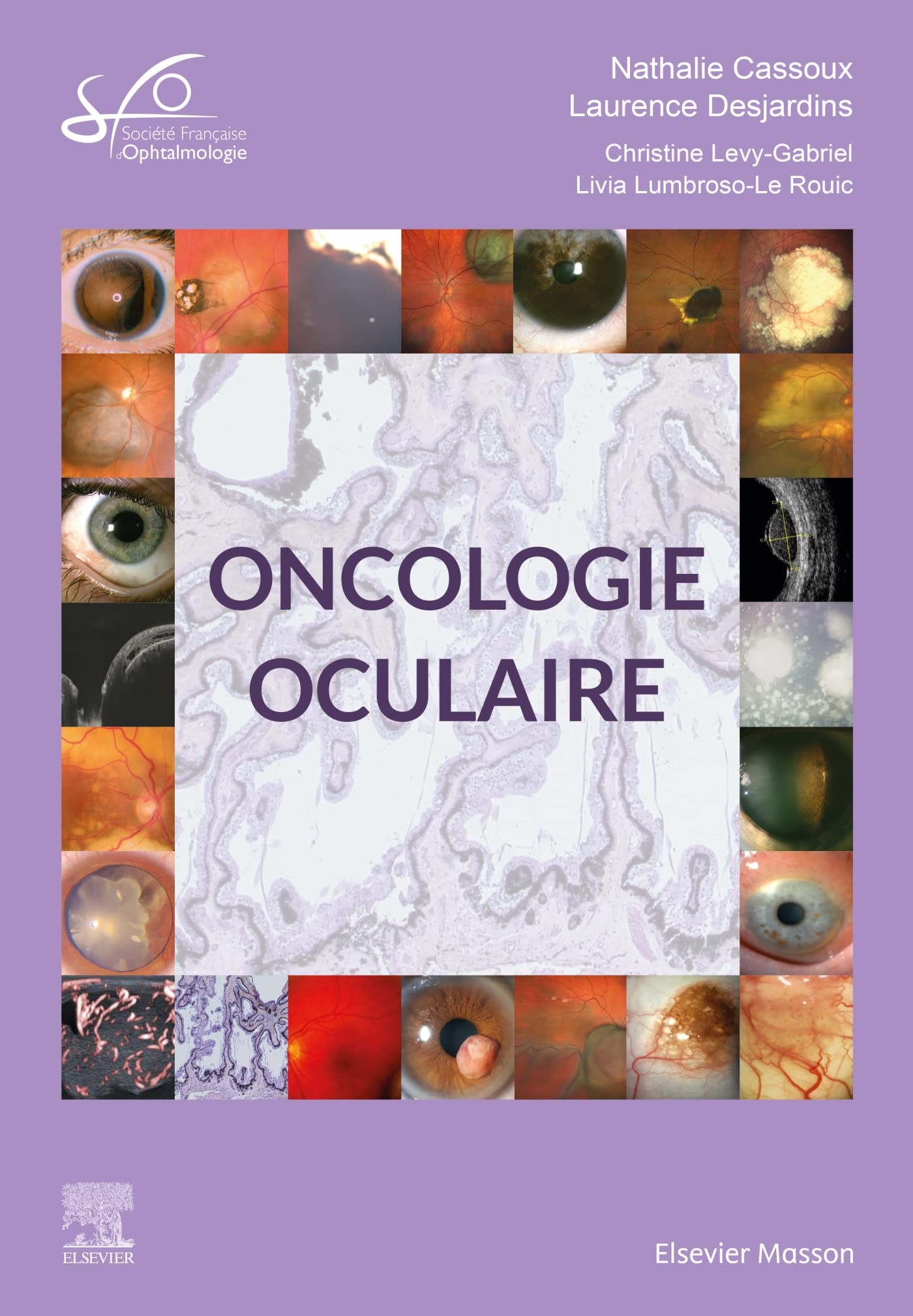 Oncologie oculaire : rapport SFO 2022
