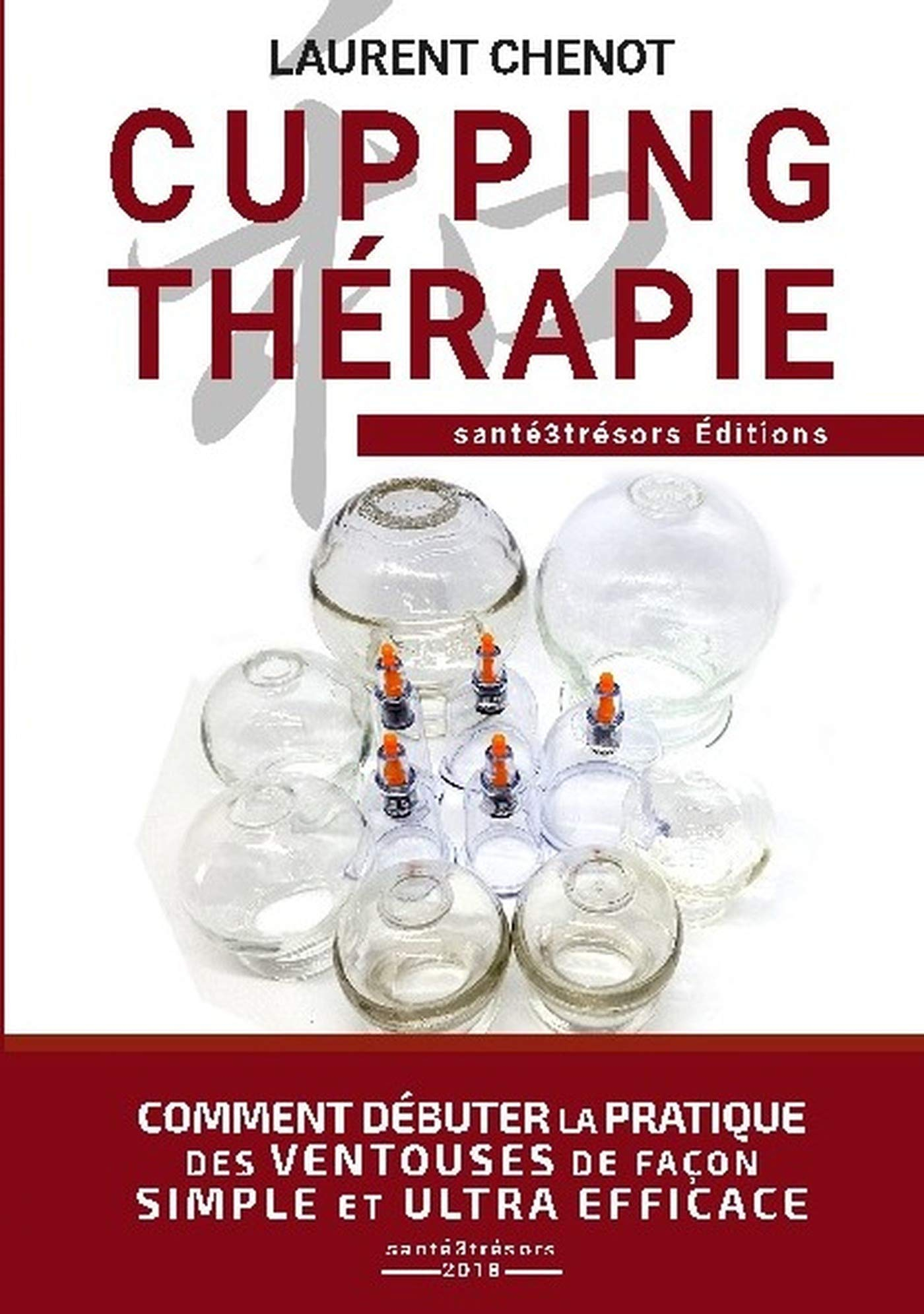 CUPPING THERAPIE : Comment débuter la pratique des ventouses de façon simple et ultra efficace.