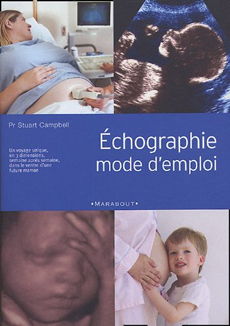 Echographie mode d'emploi : un voyage unique, en trois dimensions, semaine après semaine, dans le ve