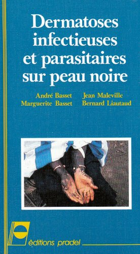 Dermatoses infectieuses et parasitaires sur peau noire