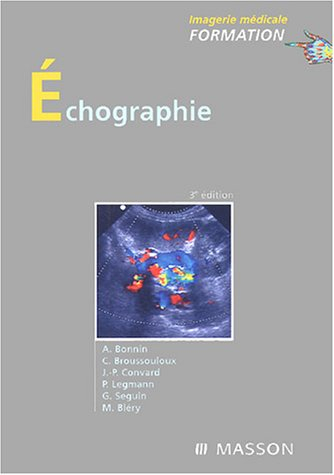 Echographie