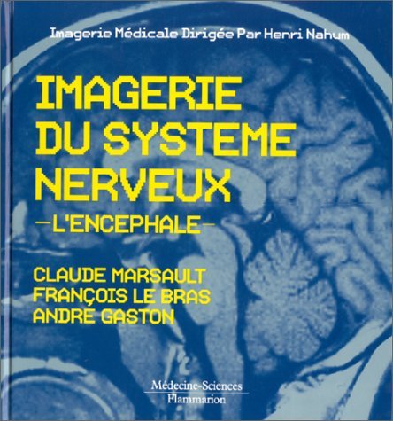 Imagerie du système nerveux : l'encéphale