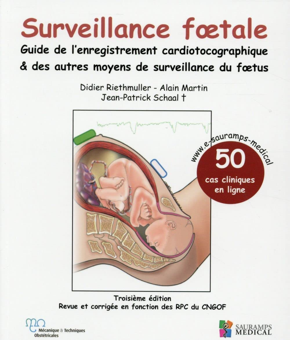 Surveillance foetale : guide de l'enregistrement cardiotocographique et des autres moyens de surveil