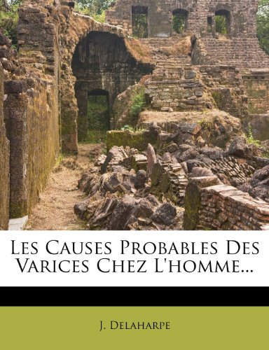 Les Causes Probables Des Varices Chez l'Homme...
