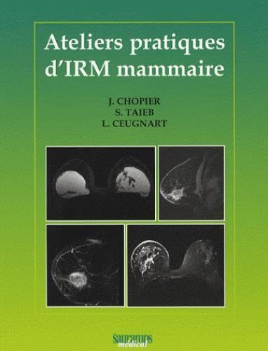 Ateliers pratiques d'IRM mammaire