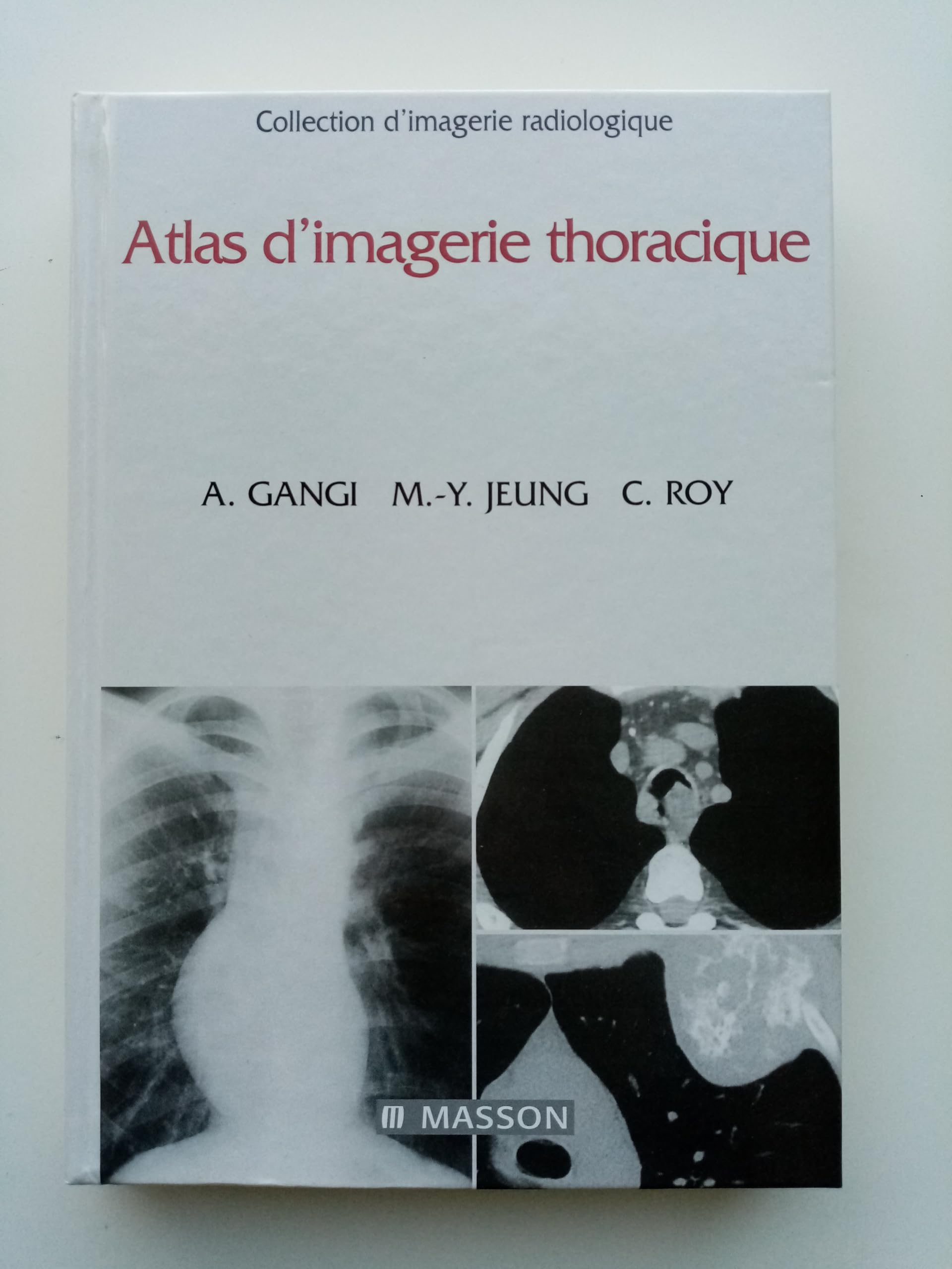 Atlas d'imagerie thoracique
