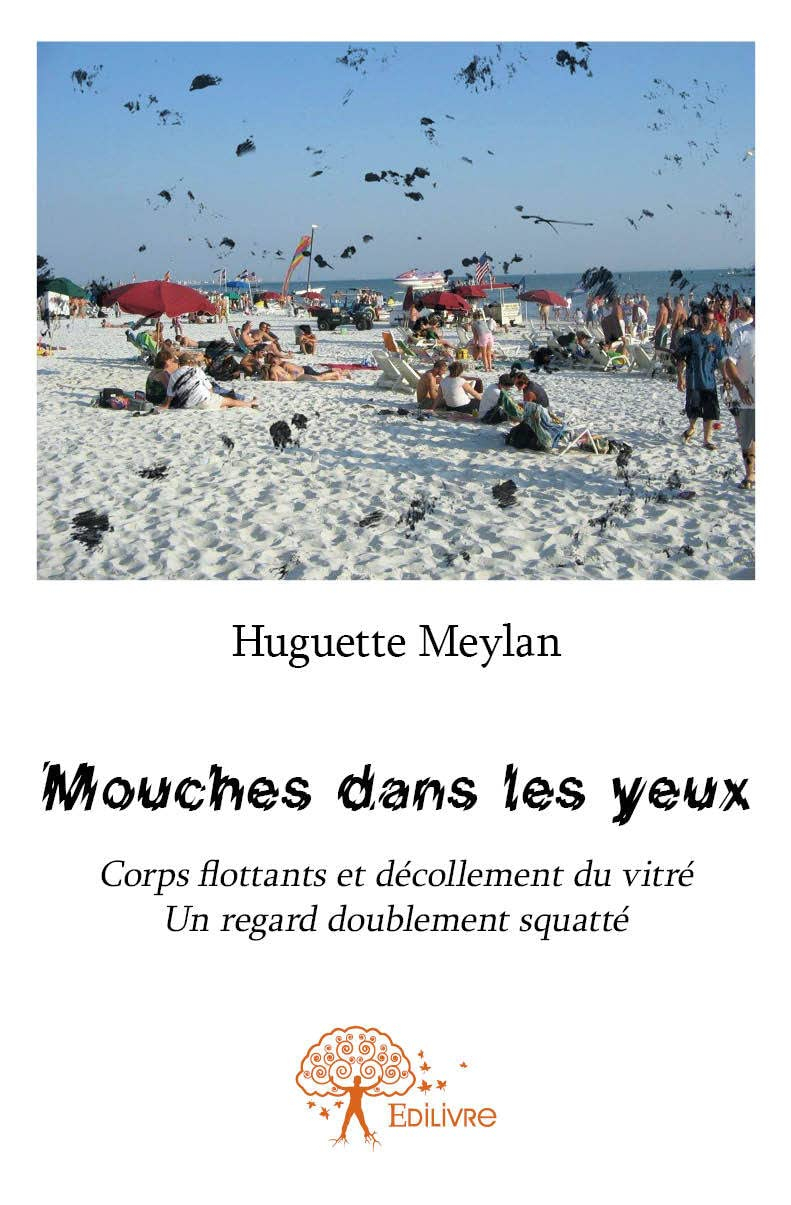 Mouches dans les yeux : Corps flottants et décollement du vitré, un regard doublement squatté
