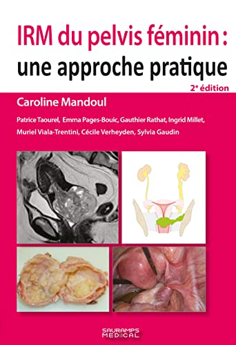 IRM du pelvis féminin : une approche pratique