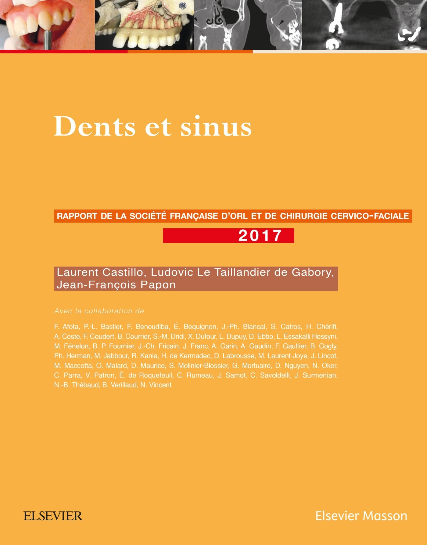 Dents et sinus : rapport 2017 de la Société française d'ORL et de chirurgie cervico-faciale