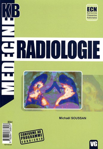 Radiologie : ECN, épreuves classantes nationales