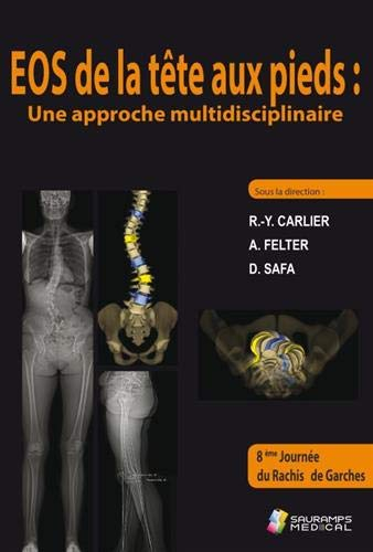 EOS de la tête aux pieds : une approche multidisciplinaire