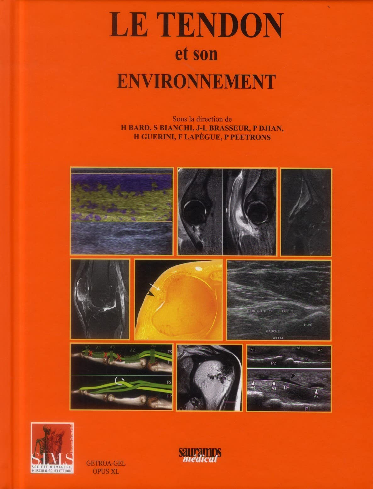 Le tendon et son environnement : bases fondamentales, autour du tendon, les tendinopathies méconnues