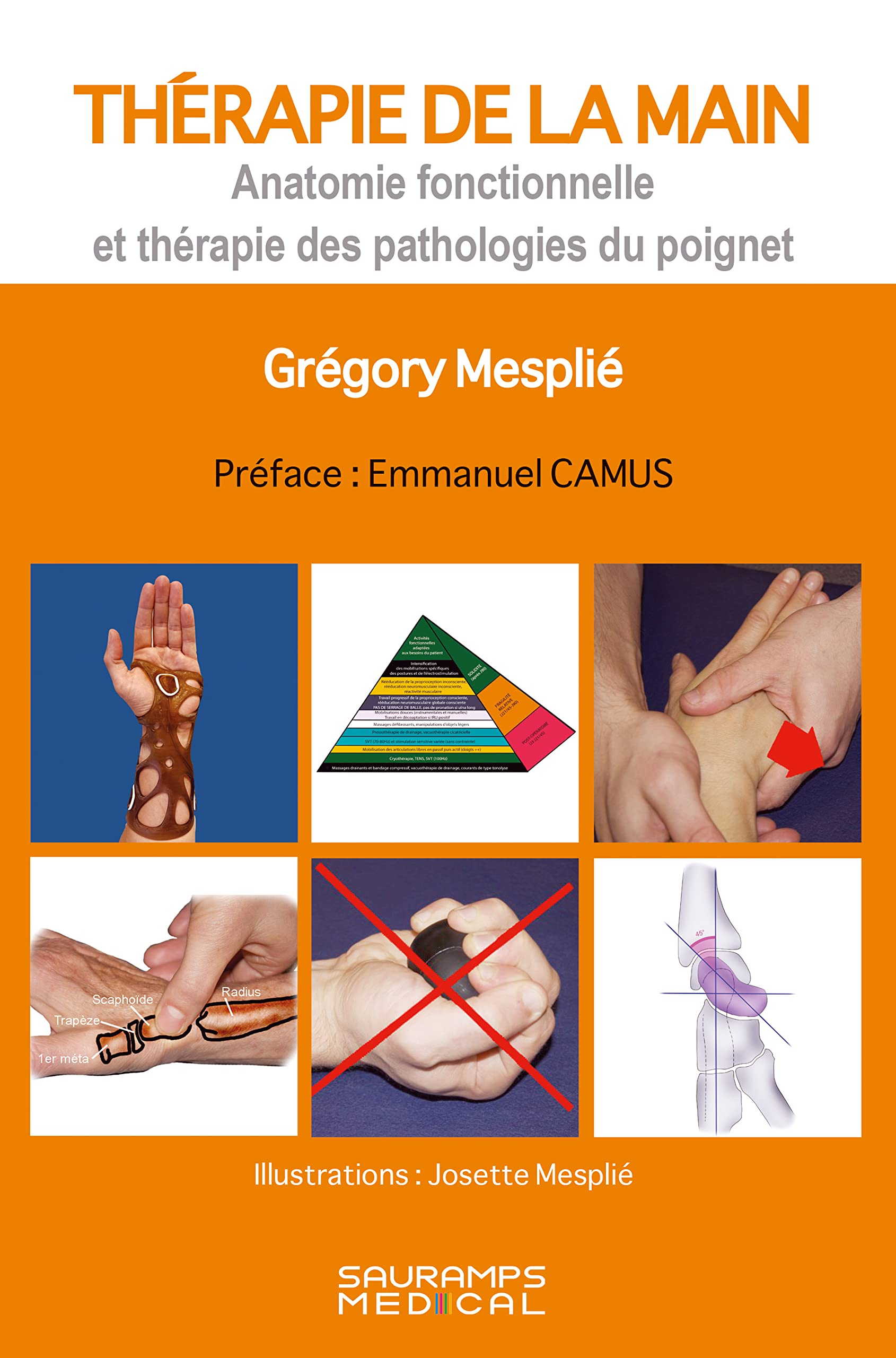 Thérapie de la main. Vol. 2. Anatomie fonctionnelle et thérapie des pathologies du poignet