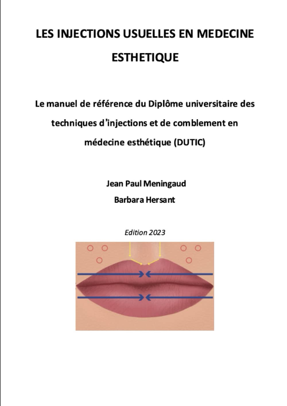 LES INJECTIONS USUELLES EN MEDECINE ESTHETIQUE: édition 2020-2021