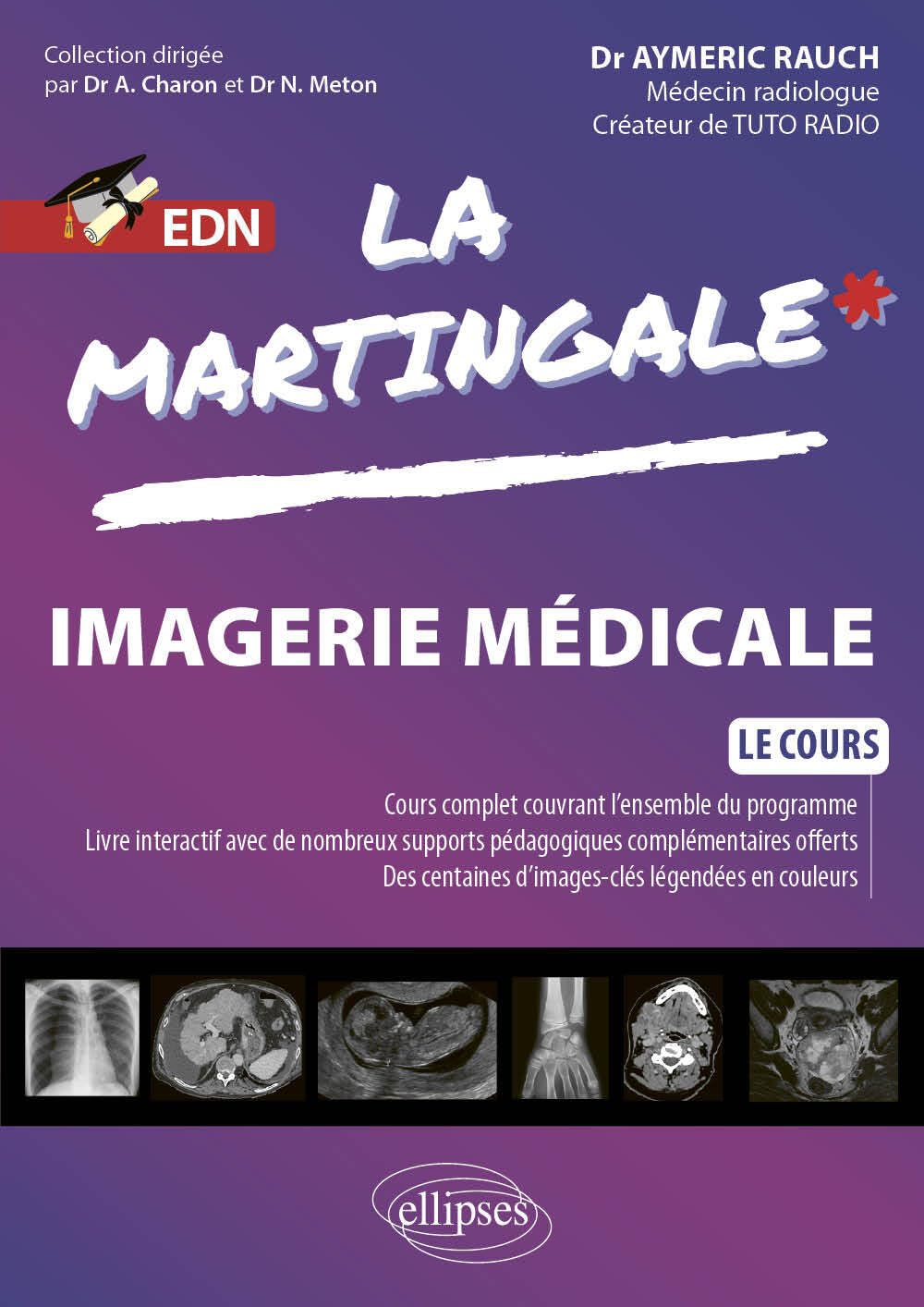 La martingale. Imagerie médicale : le cours : EDN